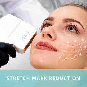 Stretch Mark Reduction