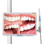 Multimedia Intraoral Camera with 18.5inch monitor with holde