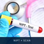 NIPT + Scan