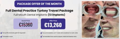 Full mouth dental implants Turkey